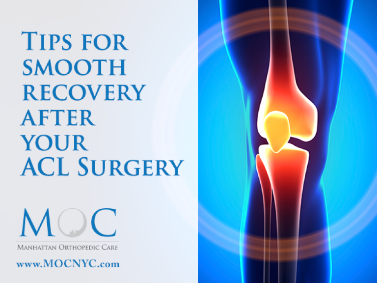 ACL Surgery Recovery Tips Manhattan Orthopedic Care
