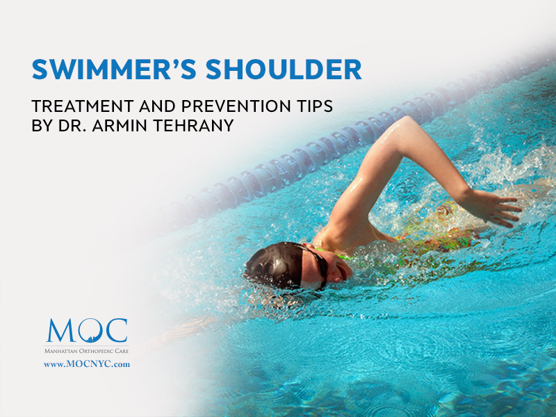 Dr. Tehrany Advises How to avoid Swimmer's Shoulder MOC