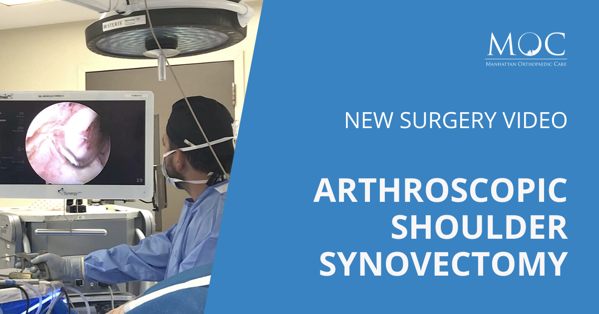 Video Arthroscopic Shoulder Synovectomy Manhattan Orthopedic Care