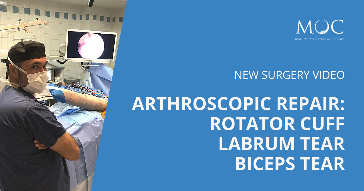 New video Arthroscopic Rotator Cuff Repar Manhattan Orthopedic Care