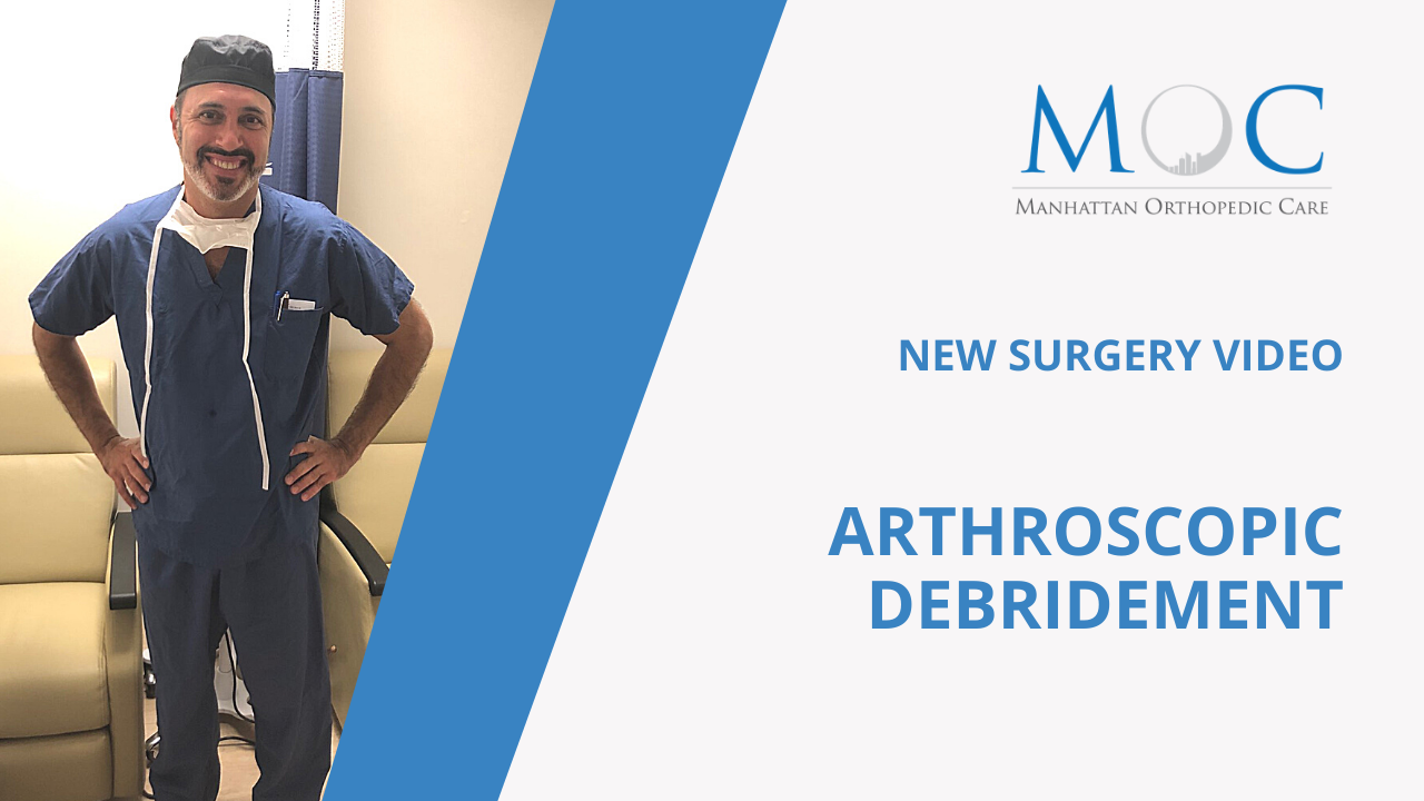 Surgery video Arthroscopic Debridement Manhattan Orthopedic Care