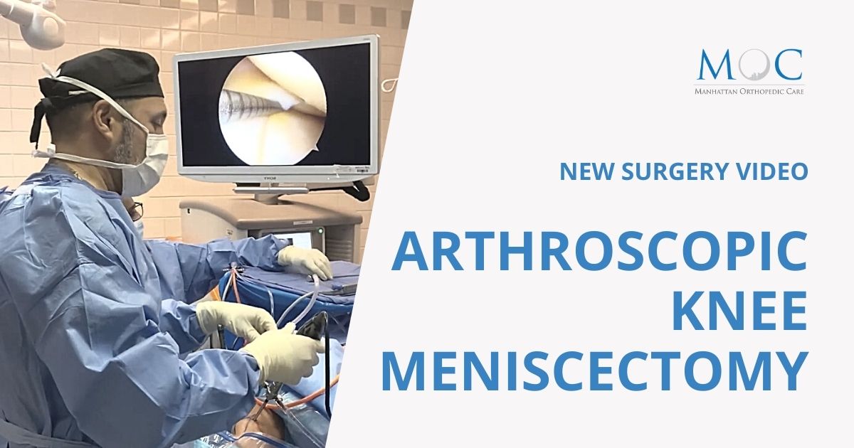 Video Arthroscopic knee meniscectomy Manhattan Orthopedic Care